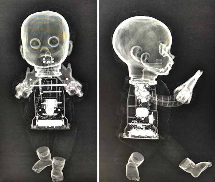 radiografías muñeca